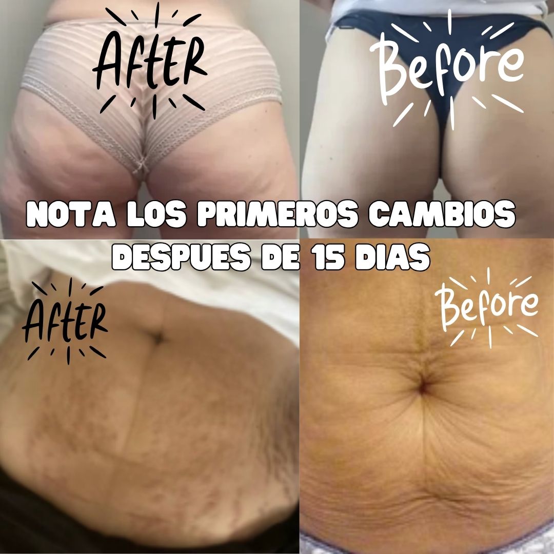 ADEUS Crema Celulitis -Estrías 300ml