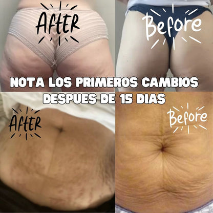 ADEUS Crema Celulitis -Estrías 300ml